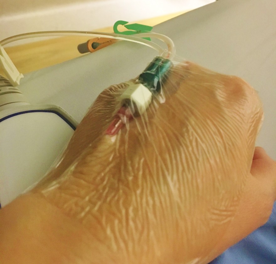 My IV line whilst I was in hospital